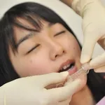 治療中イメージ